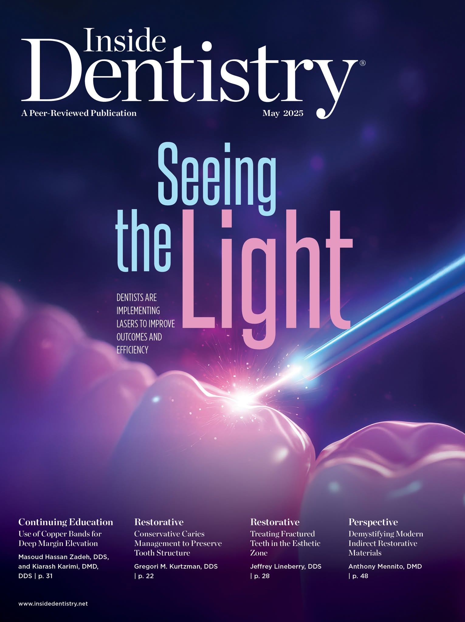 Article on Lasers for Inside Dentistry